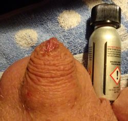miniscule penis