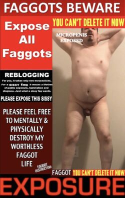 Micropenis faggot sissy completely exposed. Download, reblog and keep her that way.